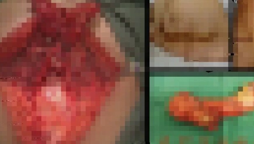 TES为什么进步这么大,澳门资料免费精准一肖一马中特,广泛的解释落实方法分析_影像版V7.70